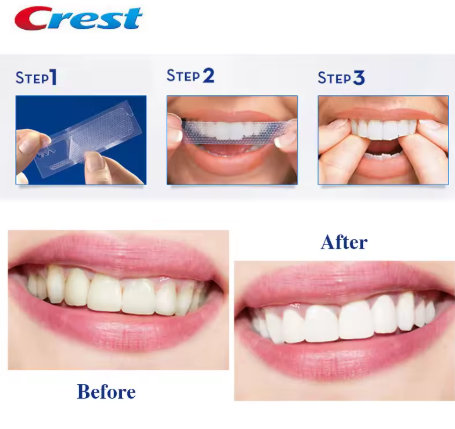 Crest Whiteningstrips Gentle - Professioneel Effect